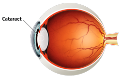 Close view of an eye